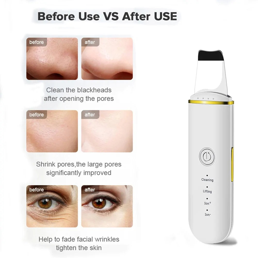 GlowGadget Ultrasonic Skin Scrubber Pro